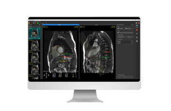 MDxp - Medical image processing software for cardiovascular MRI